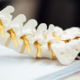 What To Expect During A Chiropractic Appointment