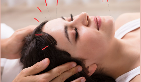 Camelback Medical Centers | Opt for Acupuncture in Scottsdale for Relief from Stress and Learn to Relax