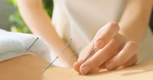Camelback Medical Centers | Comprehensive Guide to Chiropractic and Acupuncture