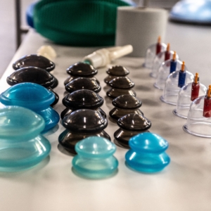 Cupping in Scottsdale AZ