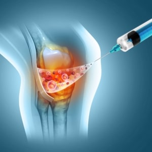 Regenerative Medicine, joint injections, nerve block, epidural